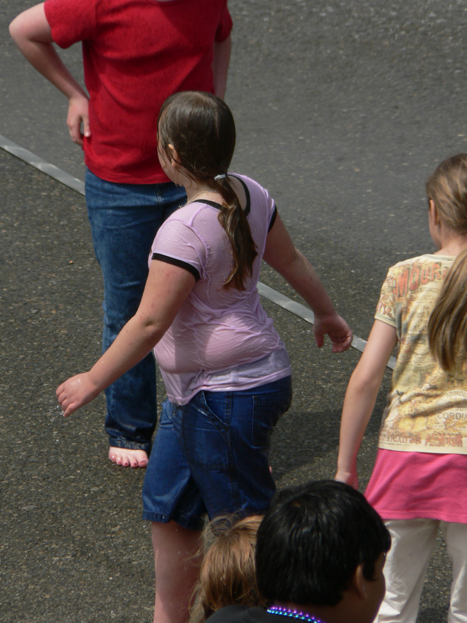 Imagem de referência de obesidade, descrito nos dados abertos como acúmulo excessivo de gordura corporal