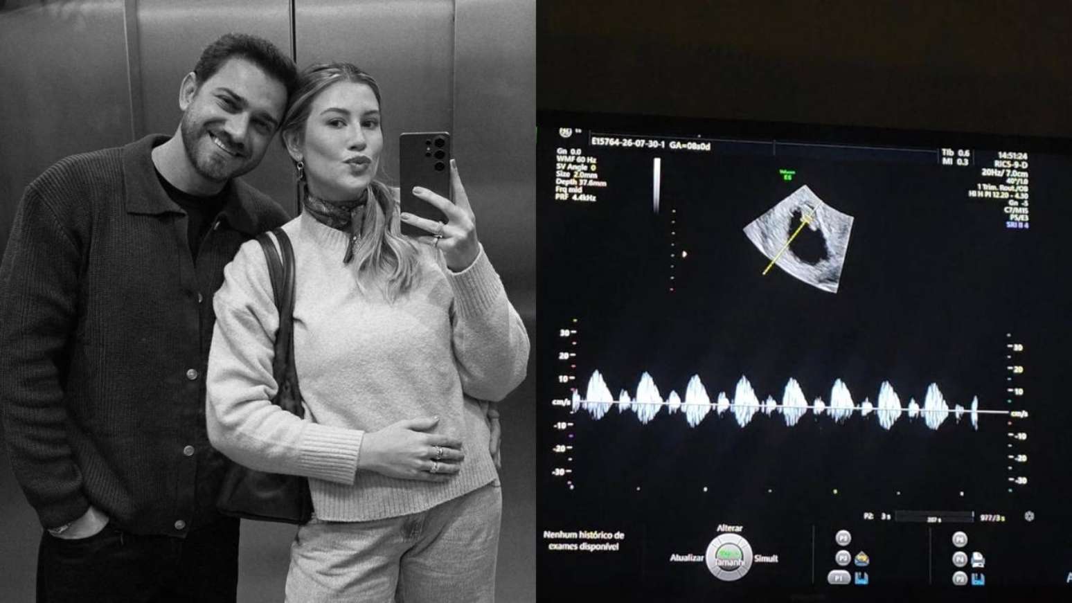 Em uma publicação nas redes sociais, Niina afirmou que não sabia se falaria sobre o assunto ou como abordaria a perda