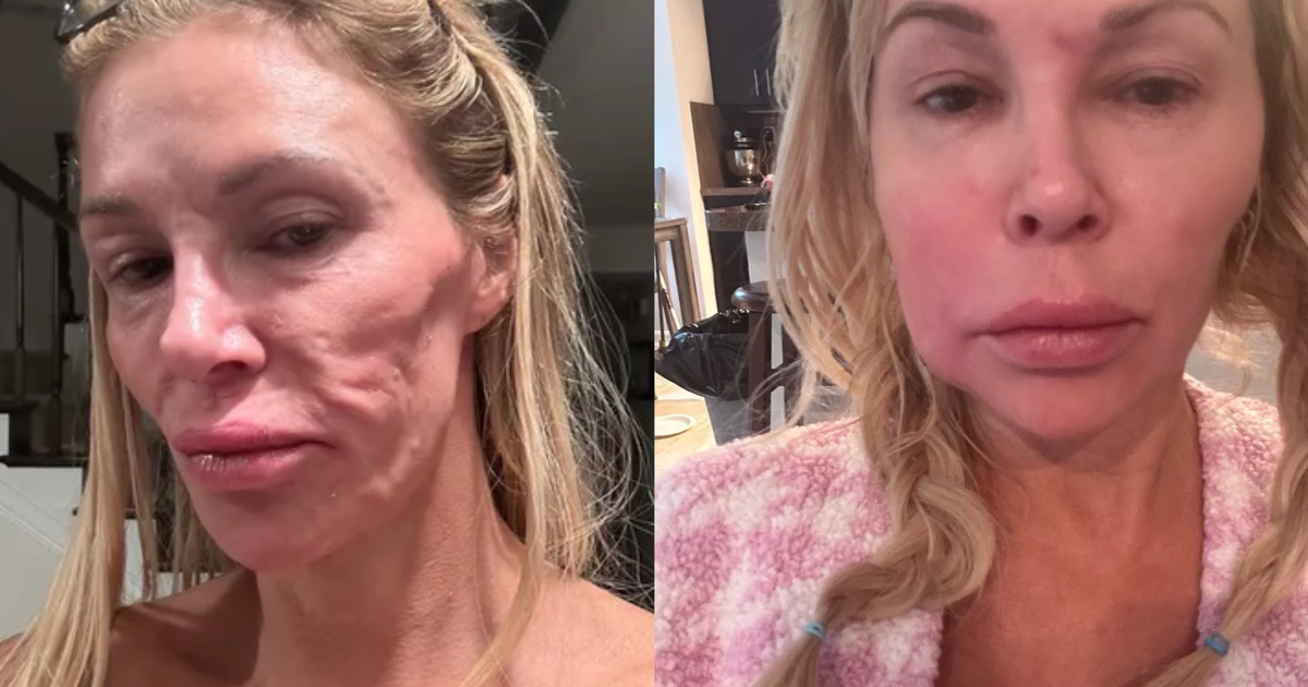 Estrela de reality show revela que vai 'tirar o rosto fora' para investigar suposto parasita