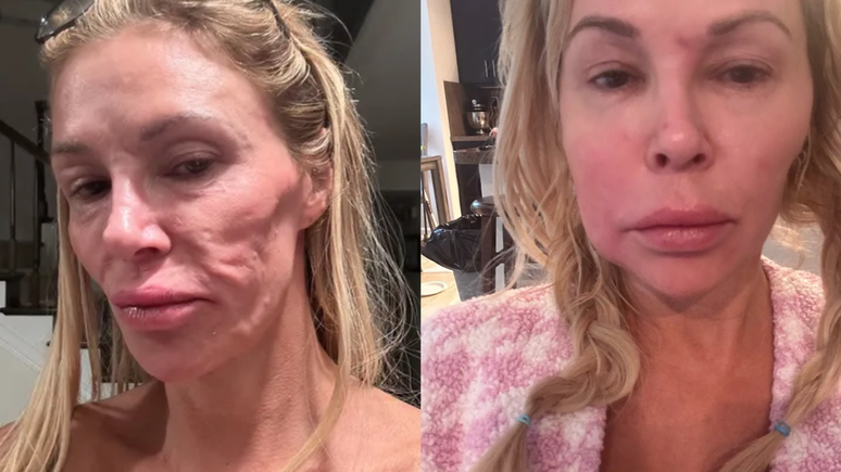 Estrela de reality show revela que vai 'tirar o rosto fora' para investigar suposto parasita
