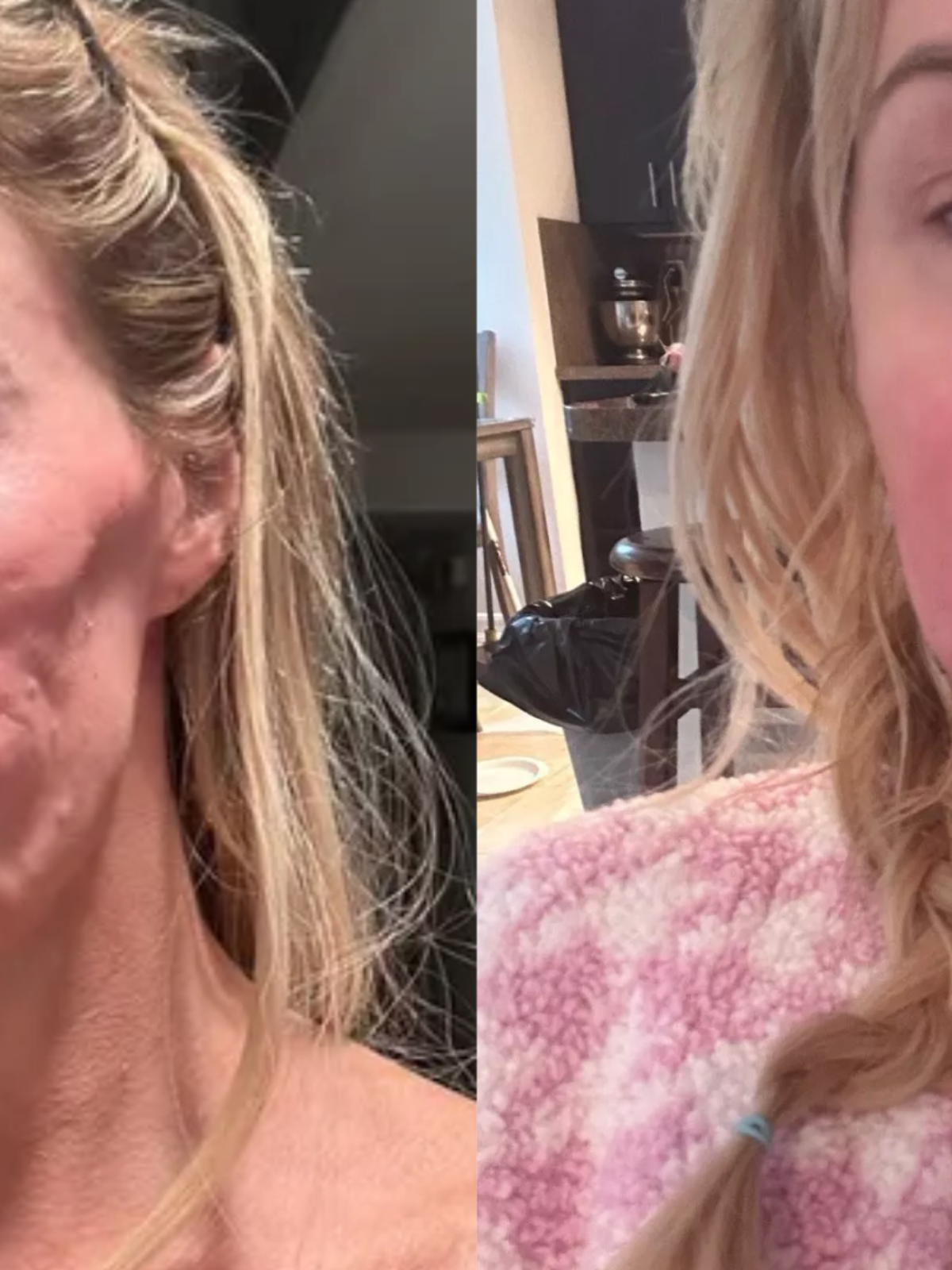 Estrela de reality show revela que vai 'tirar o rosto fora' para investigar suposto parasita