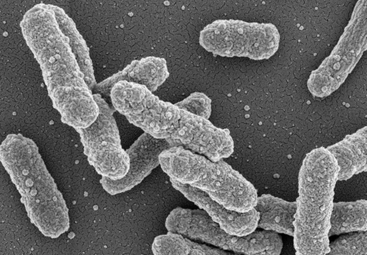 Colônia de bactérias Yersina pestis