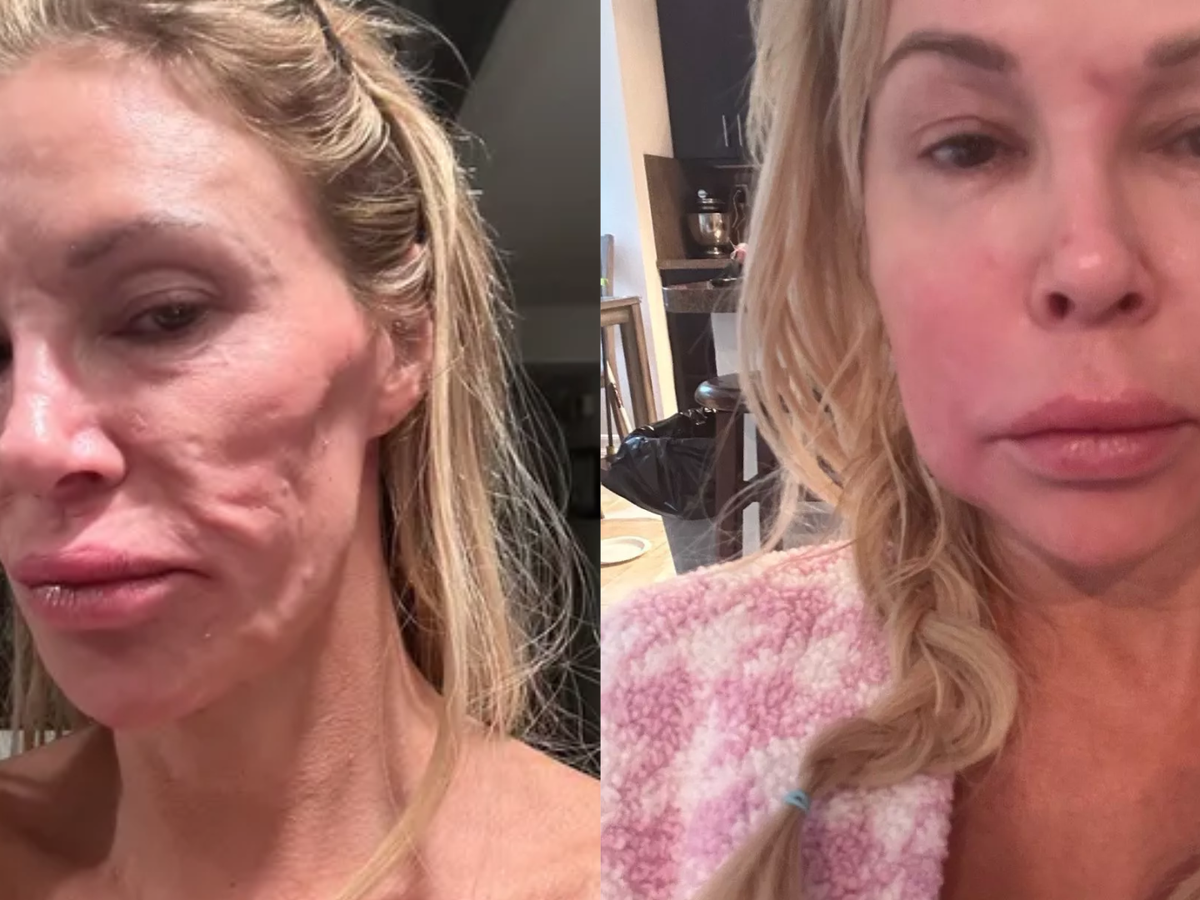 Estrela de reality show revela que vai 'tirar o rosto fora' para investigar suposto parasita