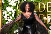 Viola Davis relembra fortes dores ao revelar diagnóstico de doença incomum