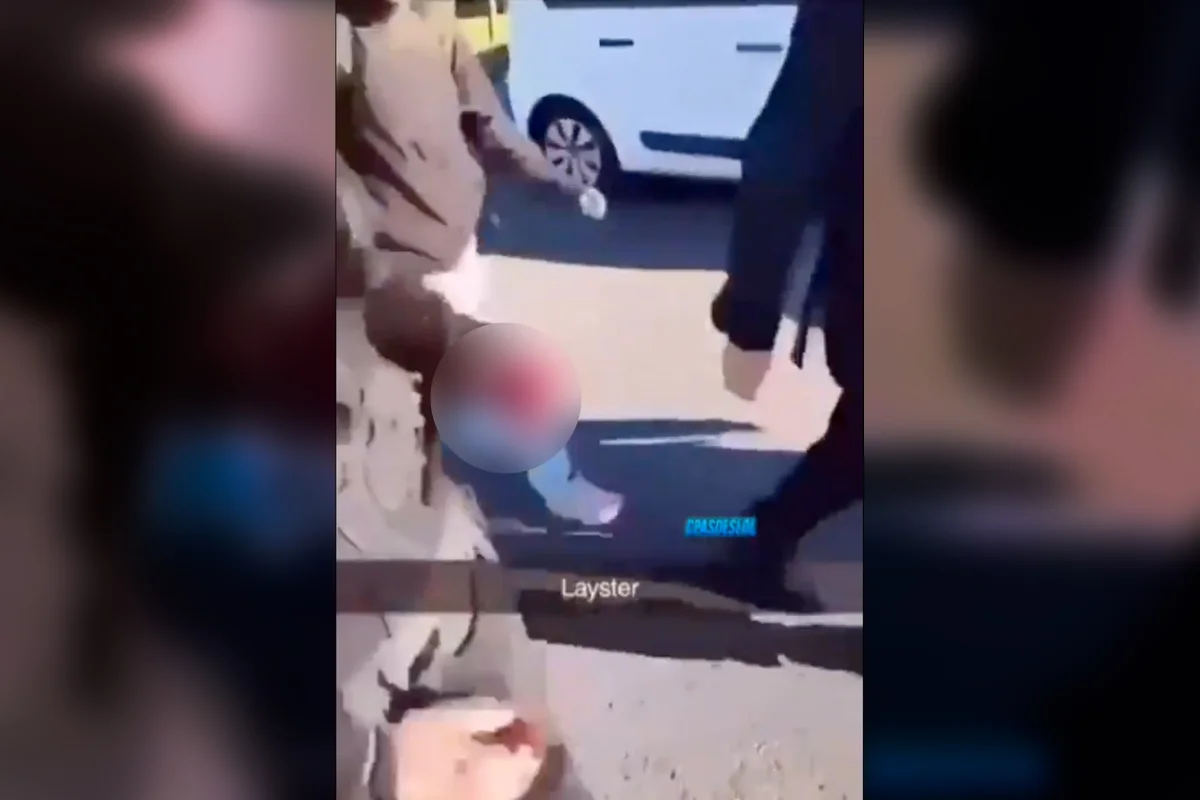Imagem colorida, Estudante de 15 anos tem mão arrancada por explosão de granada em protesto- Metrópoles