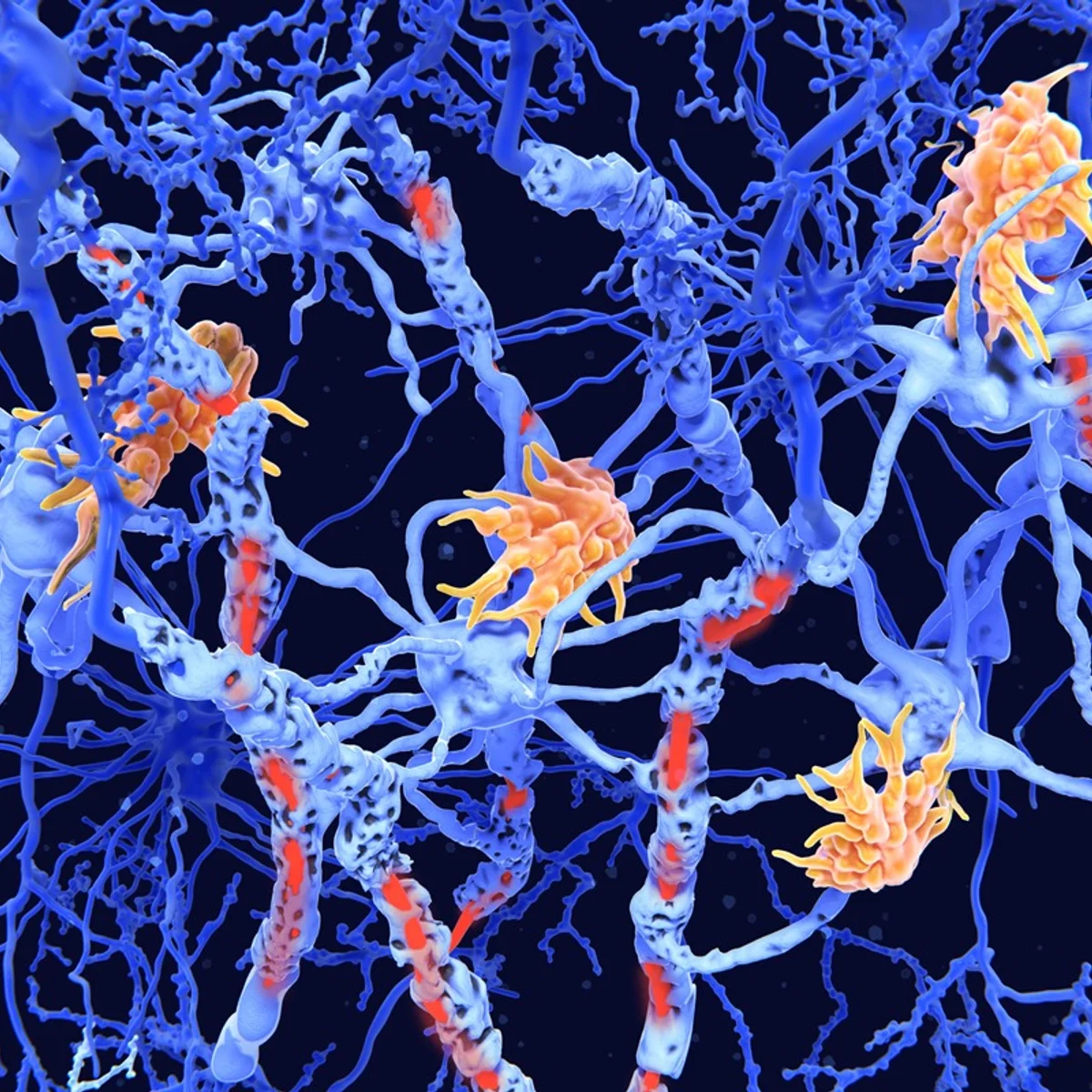 Estudo mostra avanço em terapias inovadoras para doenças neuroimunológicas