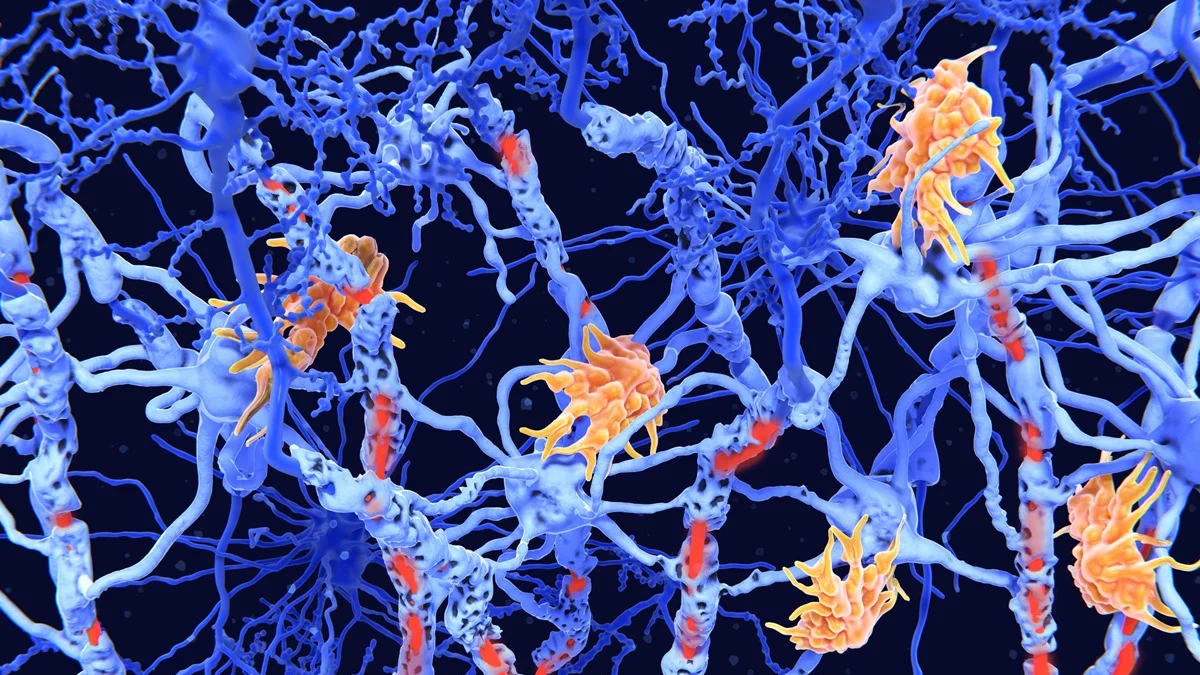 Estudo mostra avanço em terapias inovadoras para doenças neuroimunológicas