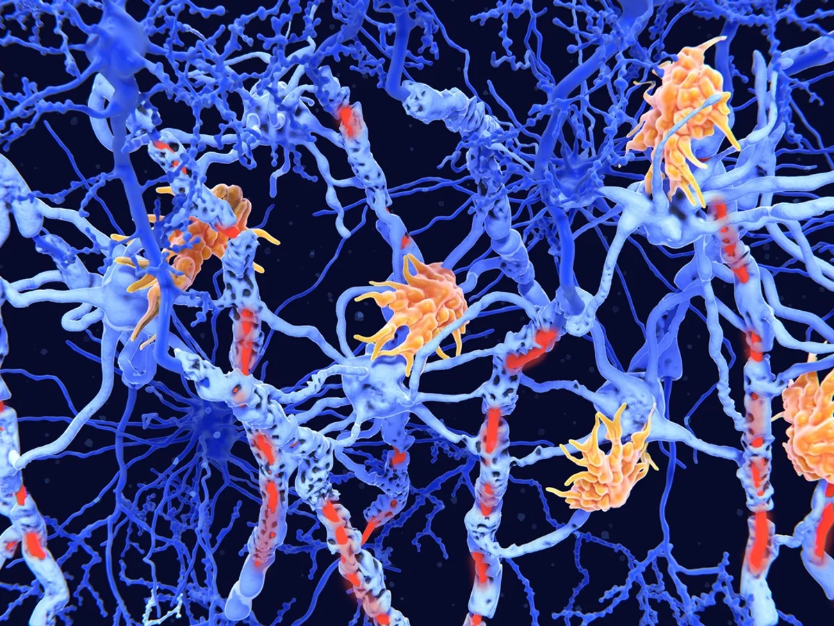 Estudo mostra avanço em terapias inovadoras para doenças neuroimunológicas